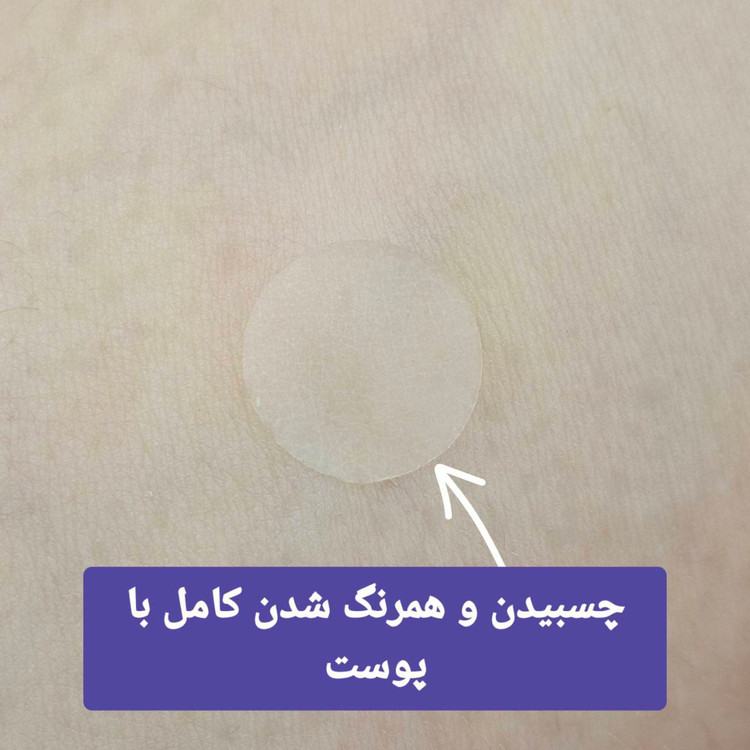 چسب جوش اورجینال برند کاریته